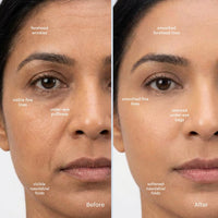 Effora's Facial Massager & Spa Wand Kit with 5 Detachable Heads | 6 Months Warranty