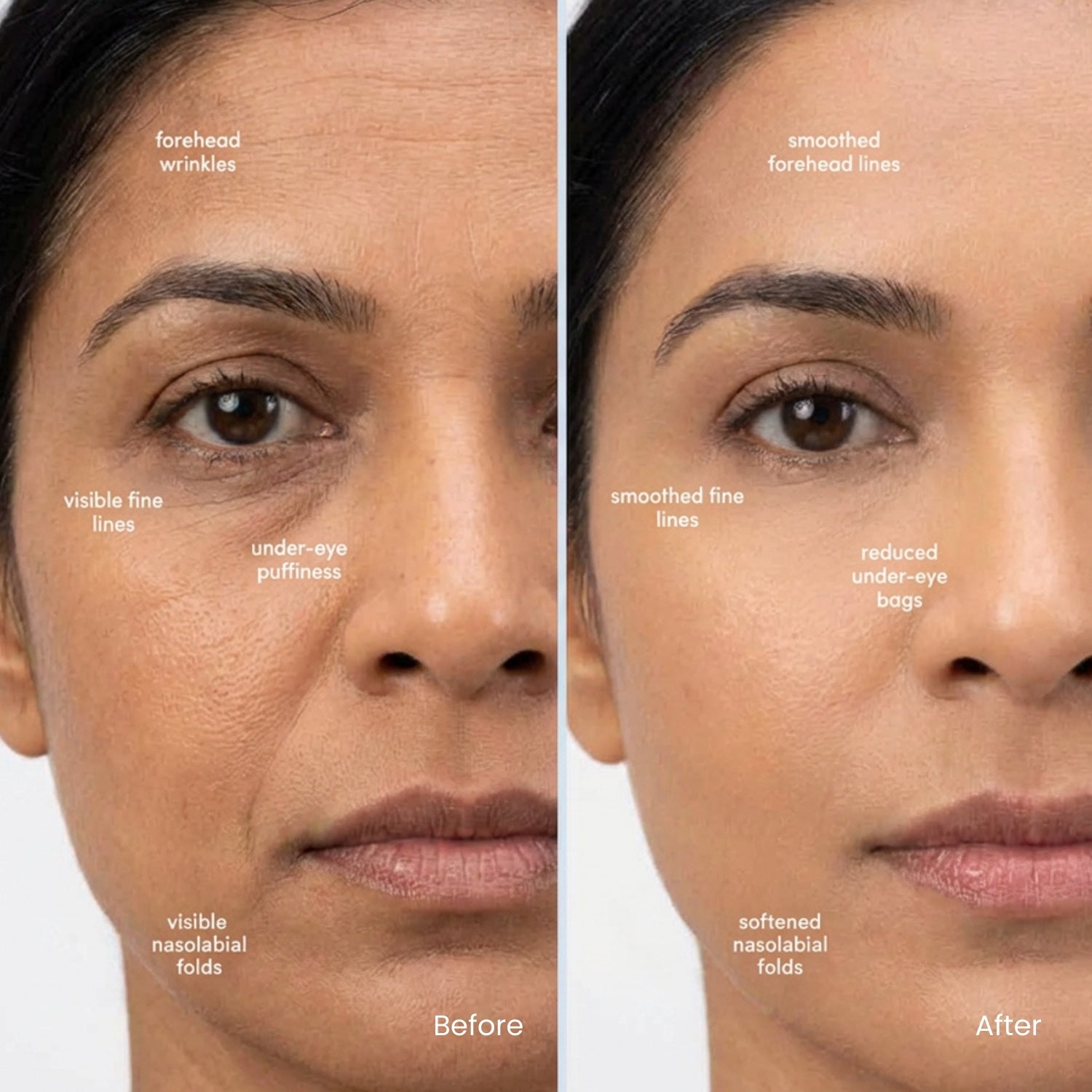 Effora's Facial Massager & Spa Wand Kit with 5 Detachable Heads | 6 Months Warranty