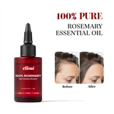 Effora's Hair Growth Booster combo | Trio Scalp Massager & Hair Density Serum (30ML)