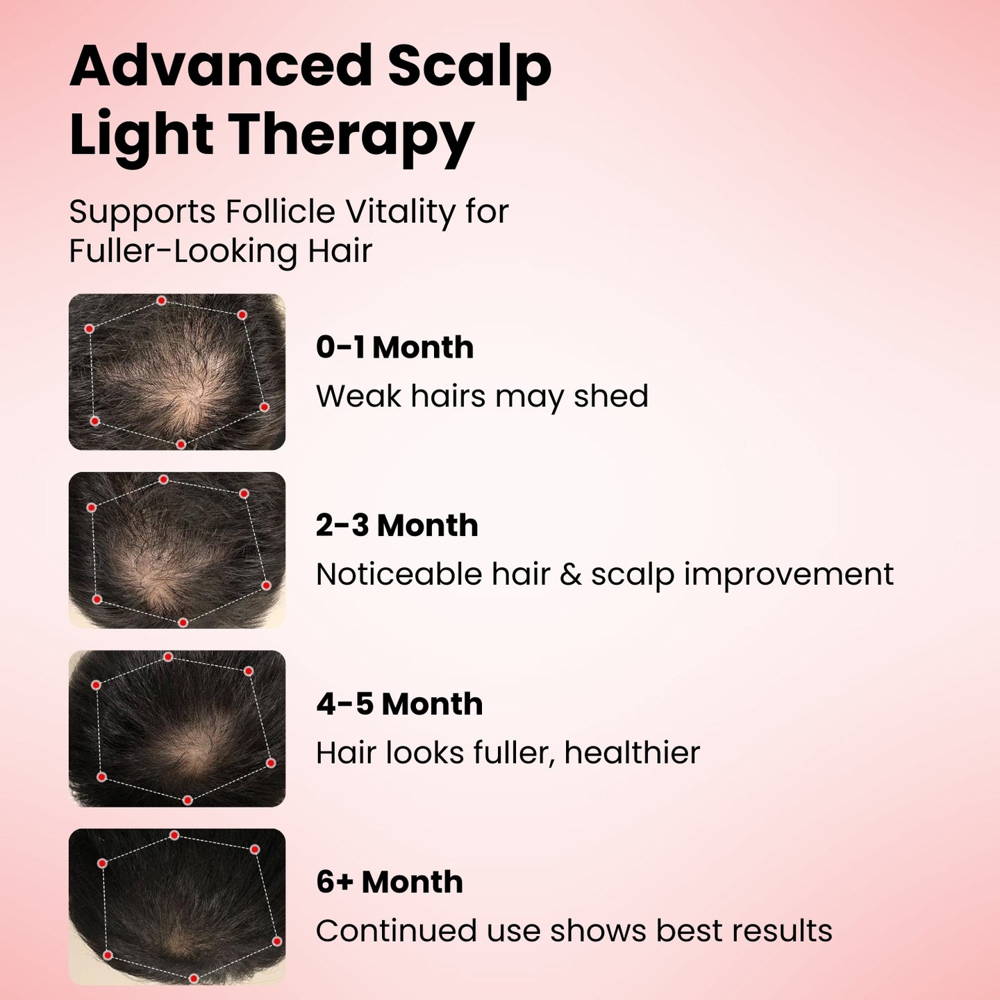 FollicleBoost Red LED Hat