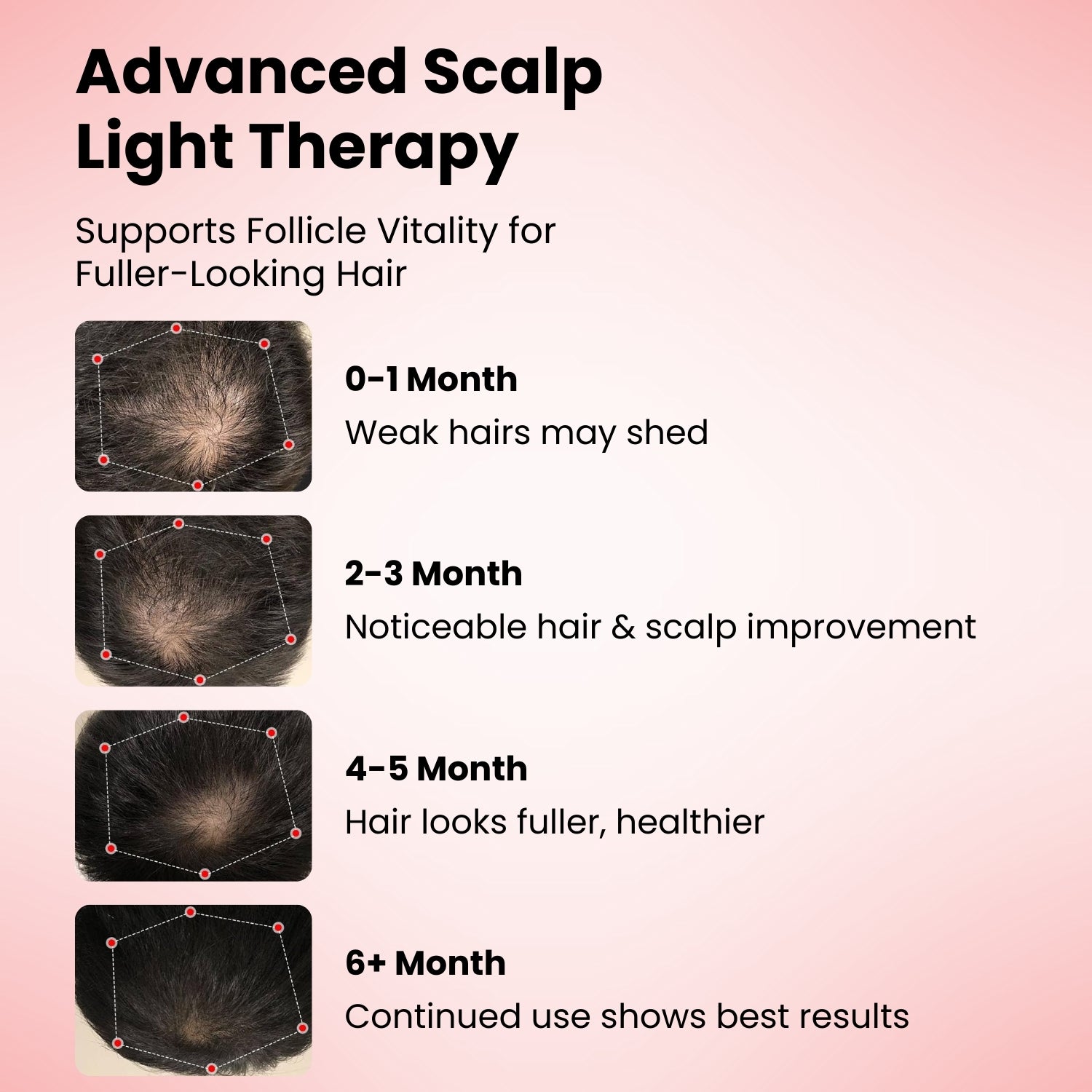 FollicleBoost Red LED Hat