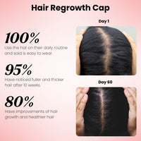 FollicleBoost Red LED Hat