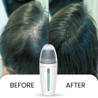 Scalp Microneedling Serum Applicator Device